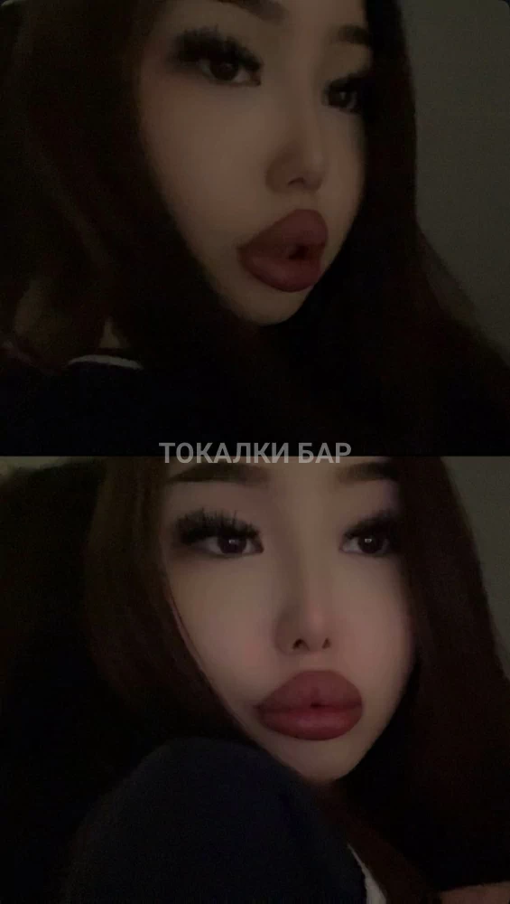 Naz